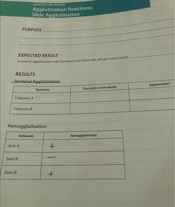 Solved EXPECTED RESULT A positive agglutination with | Chegg.com