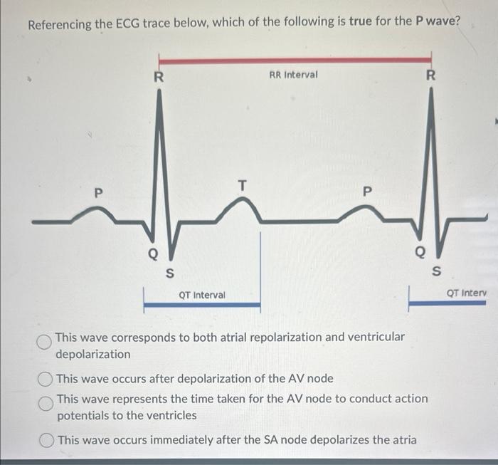 Solved Referencing the ECG trace below, which of the | Chegg.com