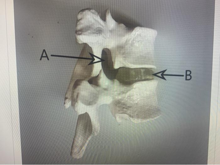 Solved A- B. | Chegg.com