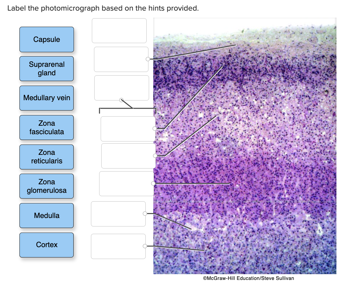 Solved Label the photomicrograph based on the hints