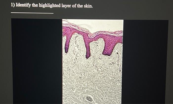 Solved 1) Identify the highlighted layer of the skin. | Chegg.com