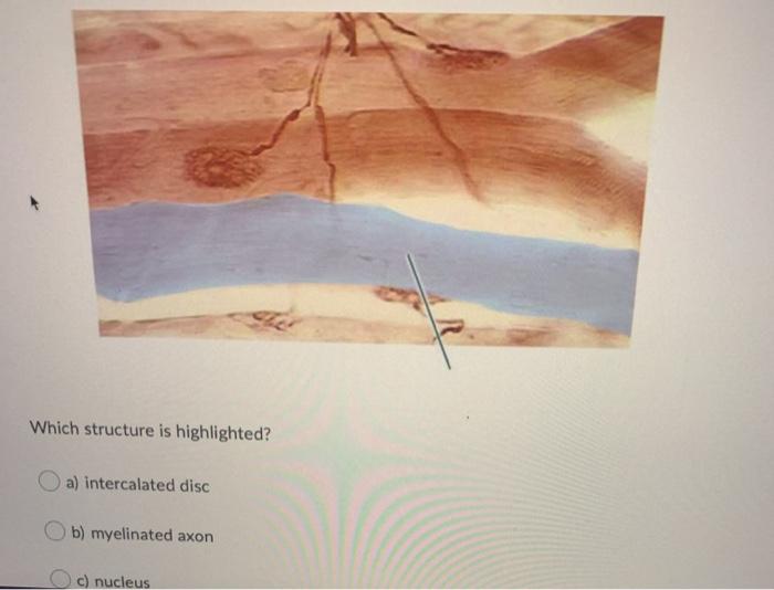 Solved Which structure is highlighted? a) intercalated disc