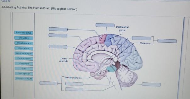 midsagittal section of the brain labeled