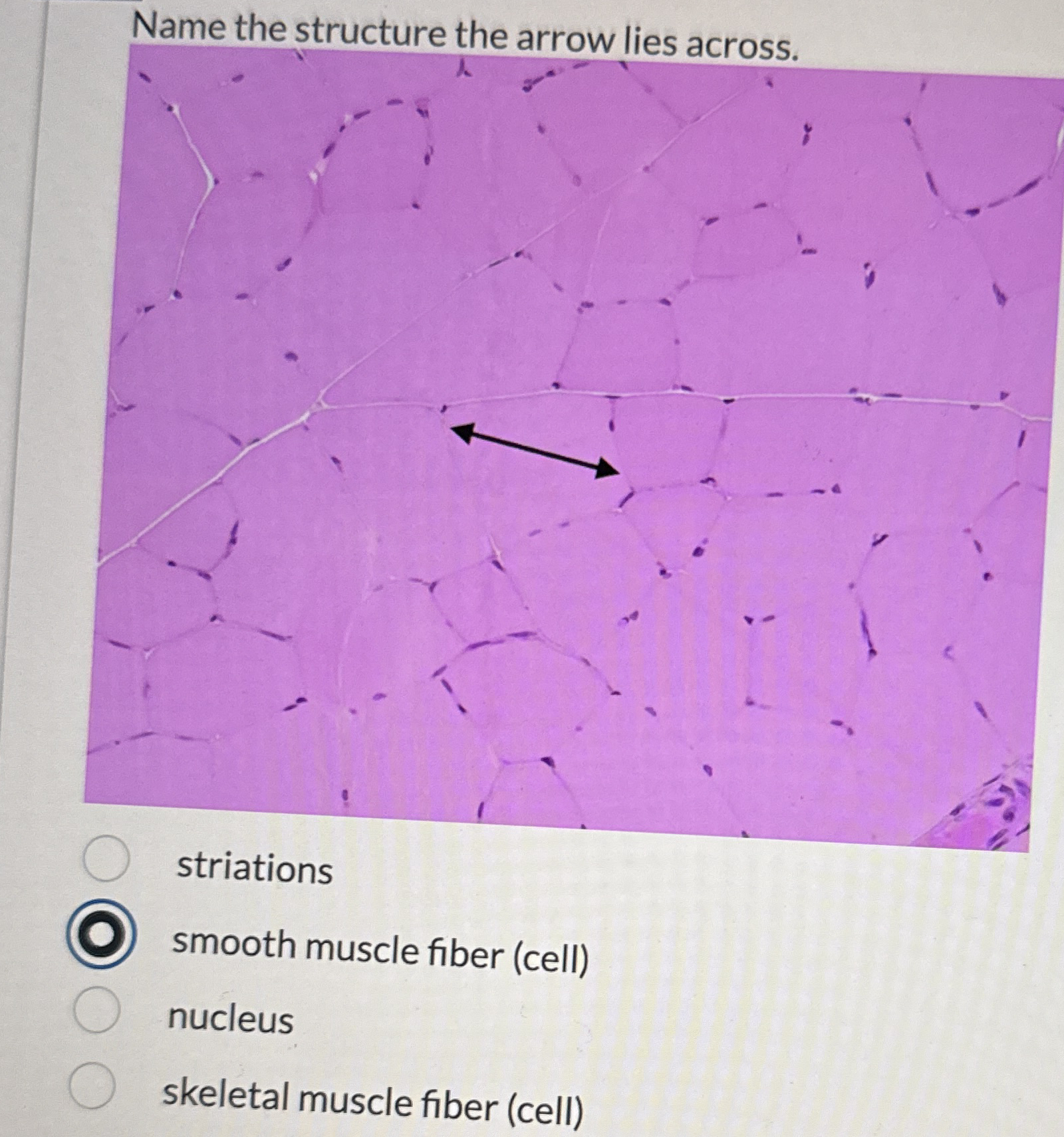 Solved Name the structure the arrow lies | Chegg.com