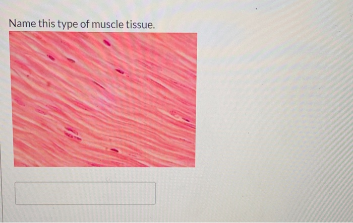 Solved Cells (pointer tip) that make the protein fibers of | Chegg.com