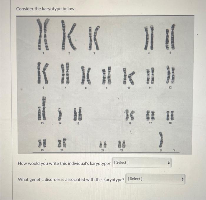 Solved Consider the karyotype below: How would you write | Chegg.com