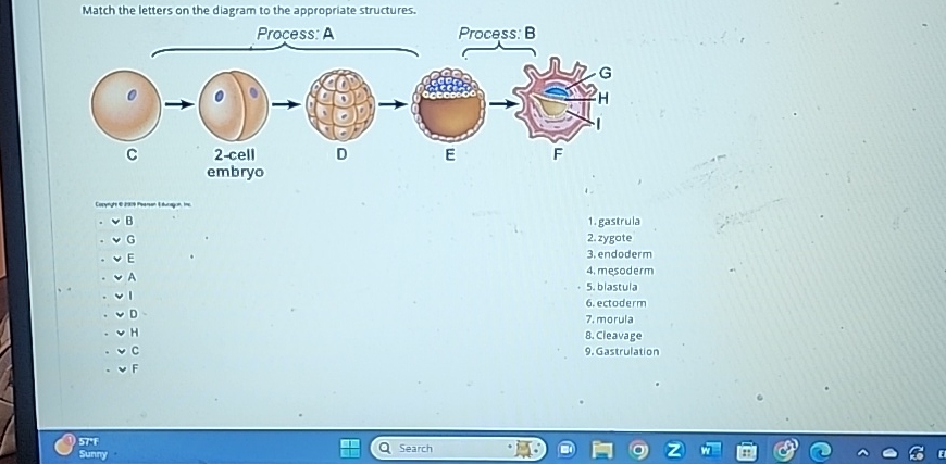 Solved Match the letters on the diagram to the aoorooriate | Chegg.com