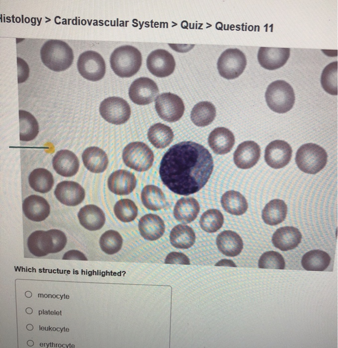 solved-histology-cardiovascular-system-quiz-questio-chegg