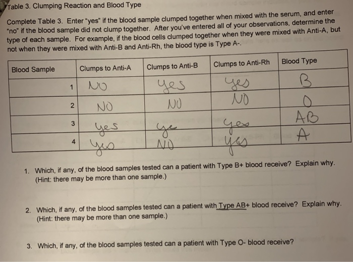 solved-table-3-clumping-reaction-and-blood-type-complete-chegg