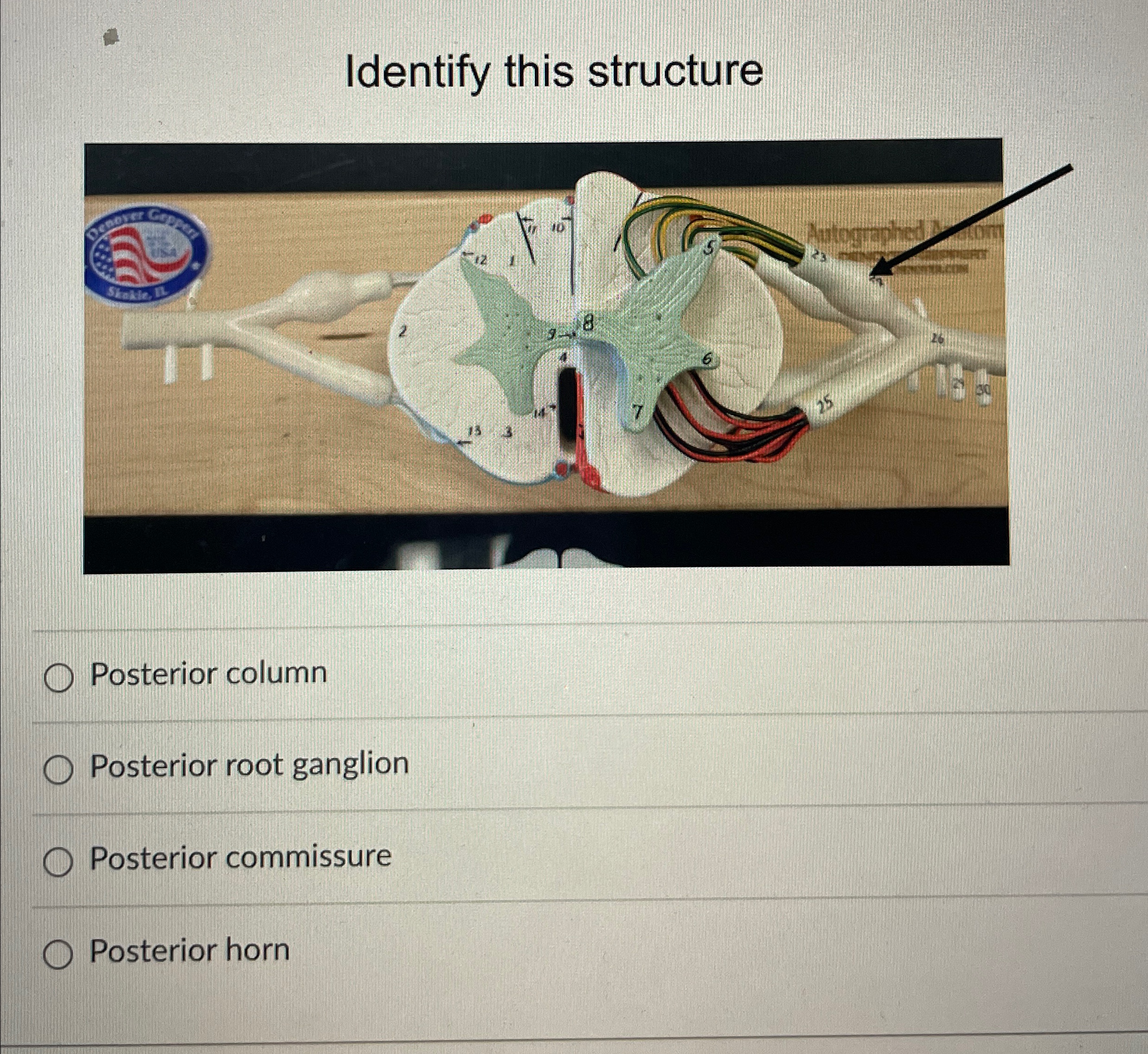Solved Identify this structurePosterior columnPosterior root | Chegg.com