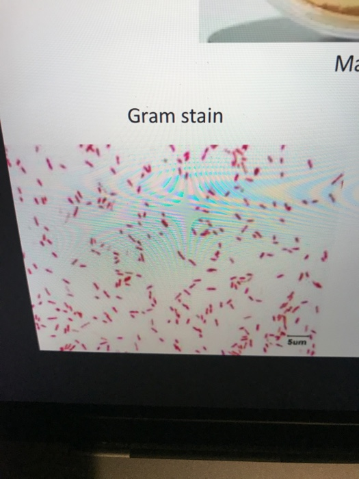 Urease Streaking Solved @ Q Search 23 Mac KIA SIM Urease Gram stain Streak on | Chegg.com