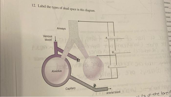 solved-12-label-the-types-of-dead-space-in-this-diagram-chegg