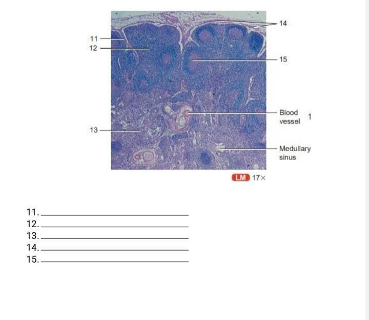 Solved Identify the parts of the Lymph node. 5 5 Germinal | Chegg.com