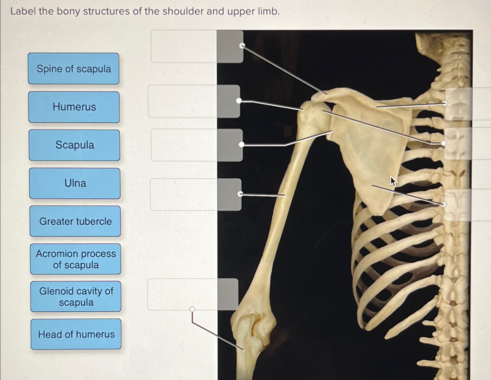 Solved Label the bony structures of the shoulder and upper | Chegg.com