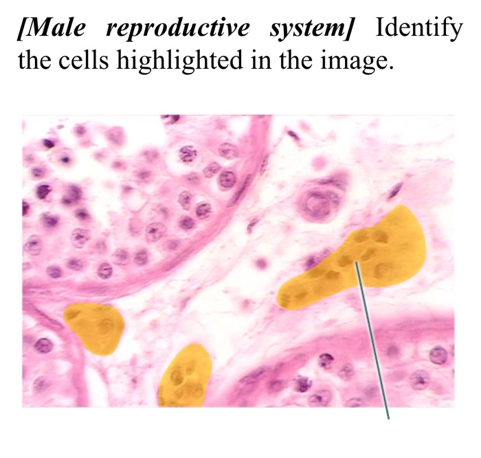 Solved 8 Photos I Need Help With All From Male Reproductive 8760