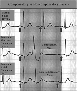 pauses on telemetry