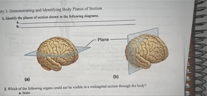Solved Demonstrating and Identifying Body Planes of Section | Chegg.com