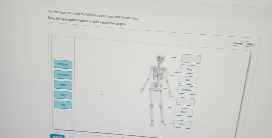 Match The Structure With Its Protective Function Solved Use the figure to match the following bone bypes with | Chegg.com