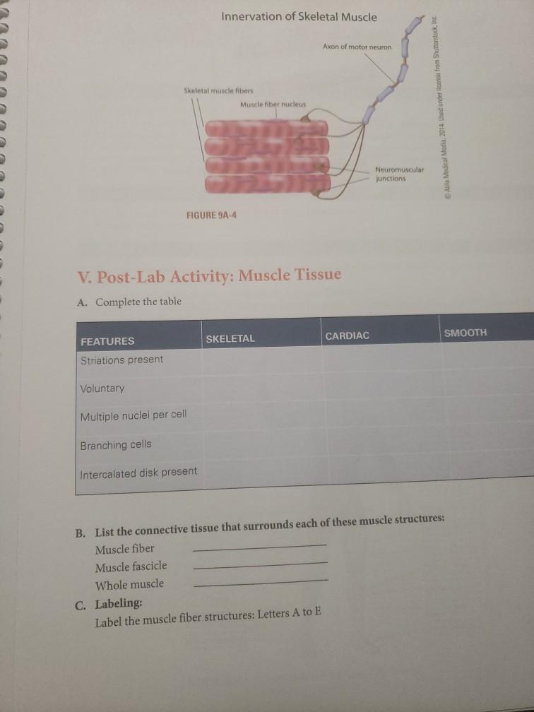 Solved Innervation of Skeletal Muscle Axon of motor neuron | Chegg.com