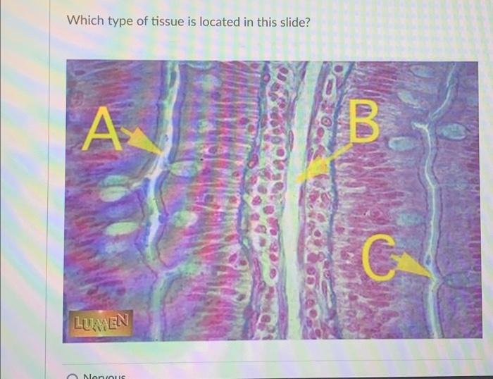 Which type of tissue is located in this slide? A | Chegg.com