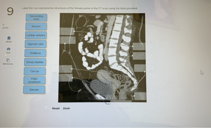 30 Label The Reproductive Structures Of The Female Pelvis Using The Hints Provided. - Labels ...