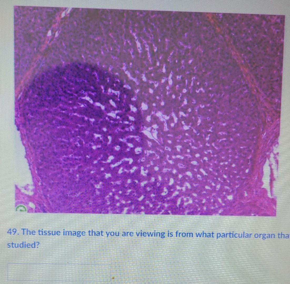 Solved 2. Urry 5 9 6 Ana 7 8 48. Medial folds of hairless