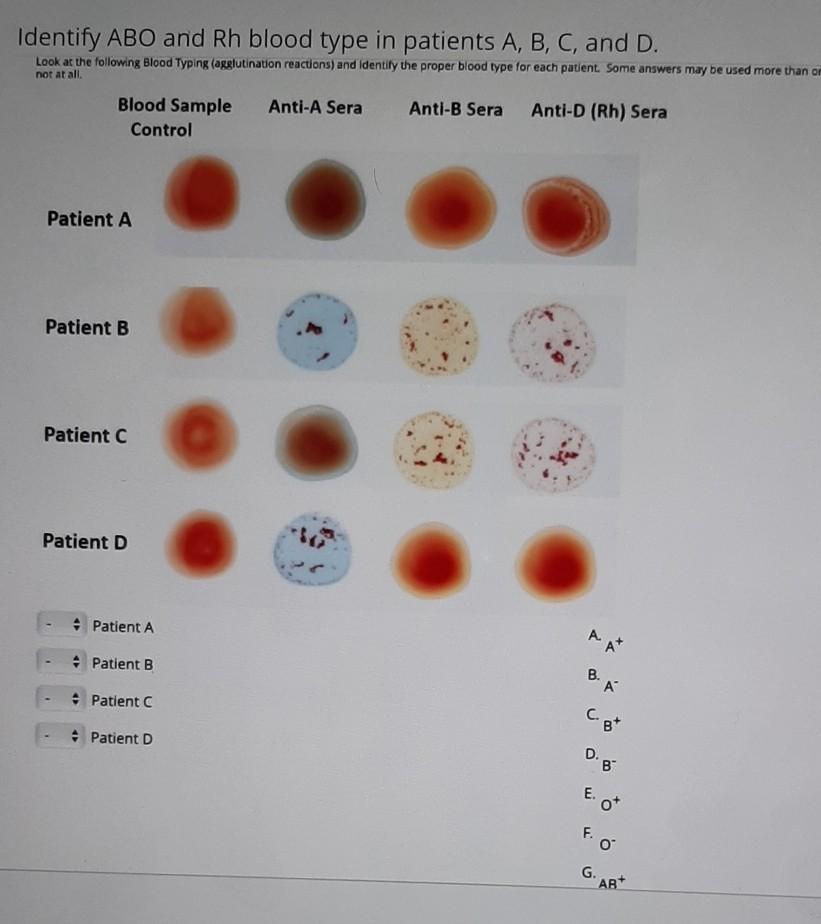 Solved Label A, B, C, D and E AC A- с D E B Label A, B, C, | Chegg.com