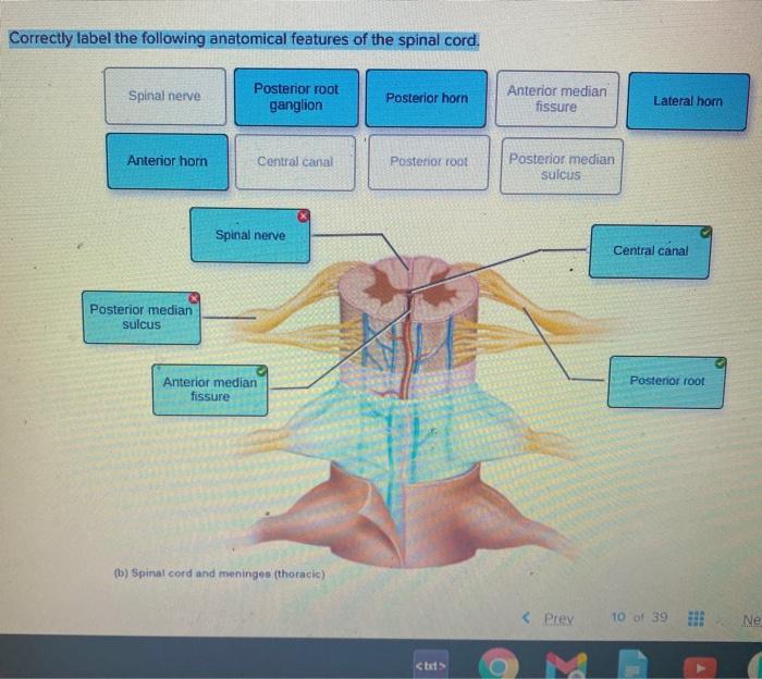 Correct Label The Following Anatomical Features Of A - vrogue.co