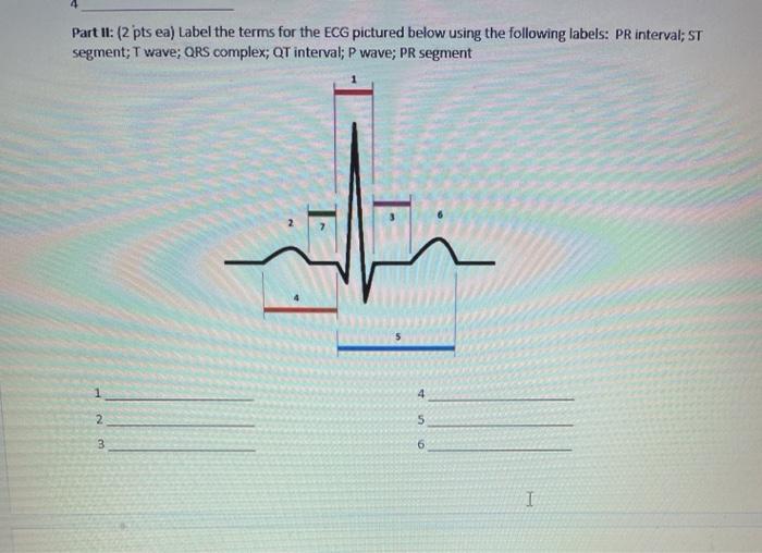 Solved Part II: (2 pts ea) Label the terms for the ECG | Chegg.com