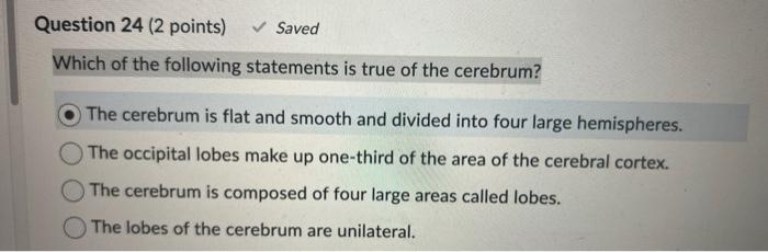 Solved Which of the following statements is true of the | Chegg.com