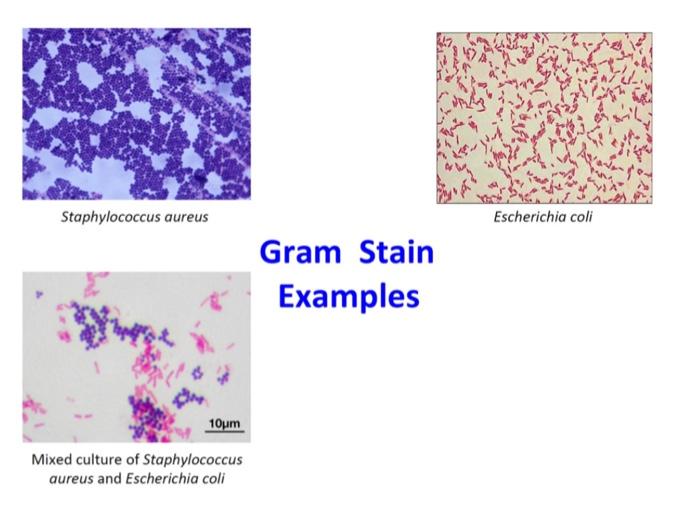 Solved write a lab report on identification of bacteria | Chegg.com