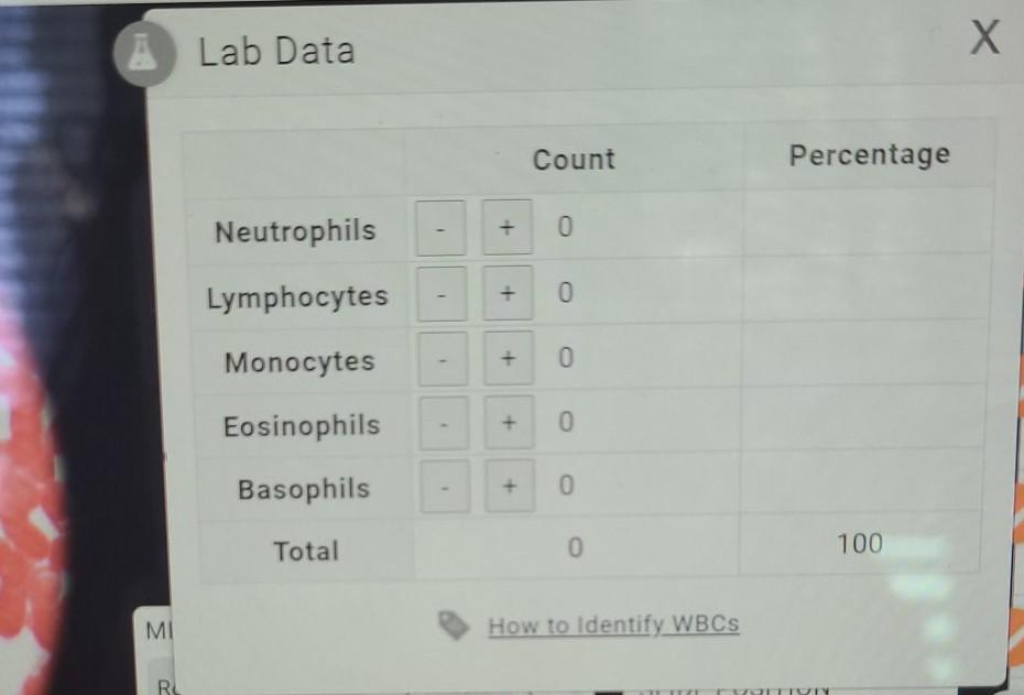 Blood Differential White Blood Cell Count