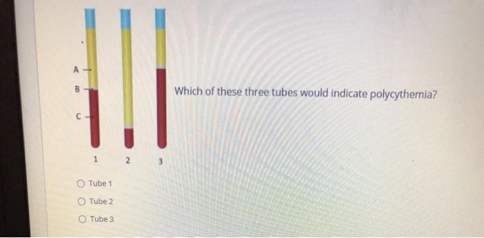 А B Which of these three tubes would indicate polycythemia? 1 2 3 Tube 1 Tube 2 Tube 3