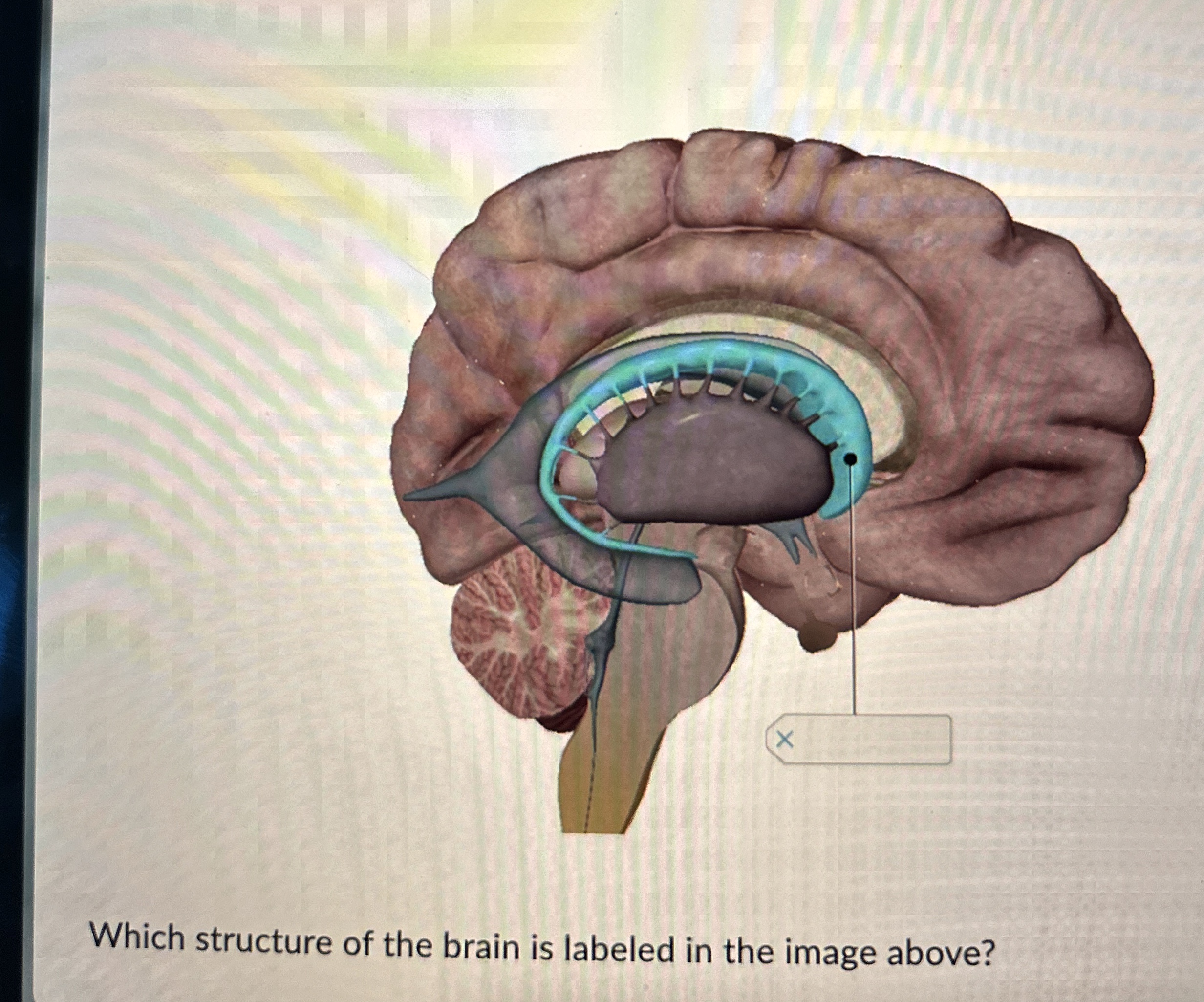 Solved Which structure of the brain is labeled in the image | Chegg.com