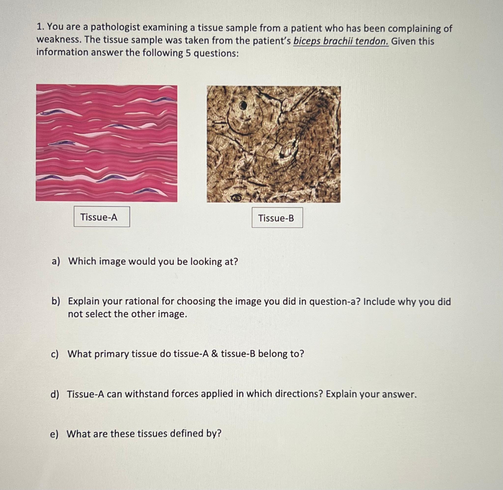 Solved You Are A Pathologist Examining A Tissue Sample From | Chegg.com