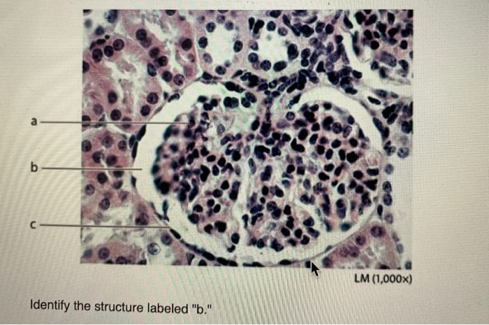 Solved A B C LM (1,000x) Identify The Structure Labeled "b." | Chegg.com