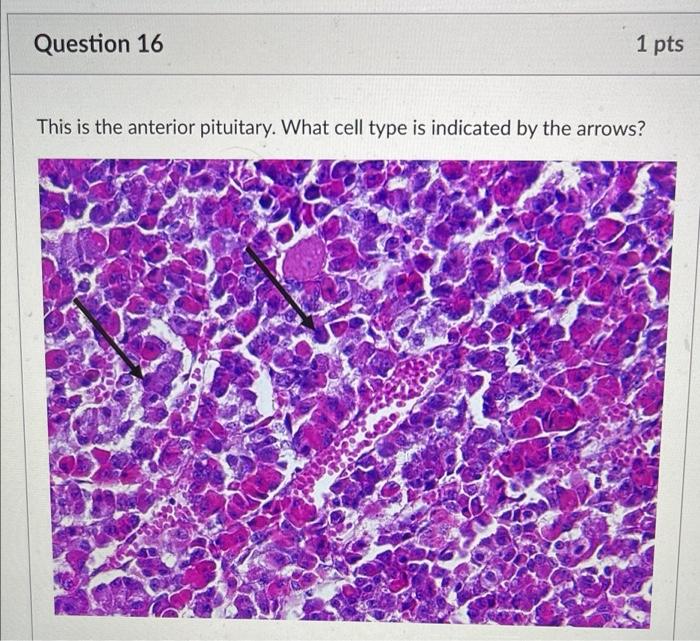 Solved Question 16 1 pts This is the anterior pituitary. | Chegg.com