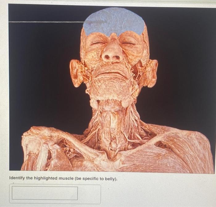 Identify the highlighted muscle. LT-M11 Deluxe | Chegg.com