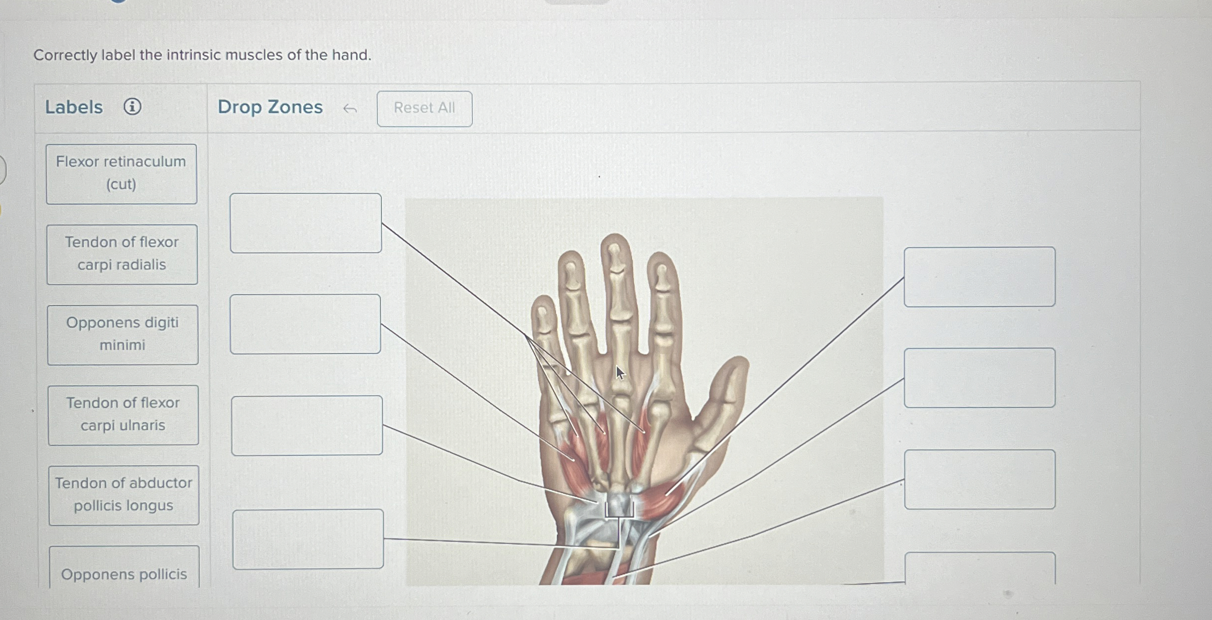 Solved Correctly label the intrinsic muscles of the | Chegg.com