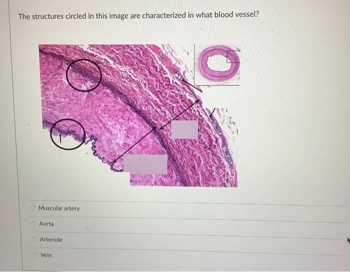 differentiation of cells changes the nucleic information true false