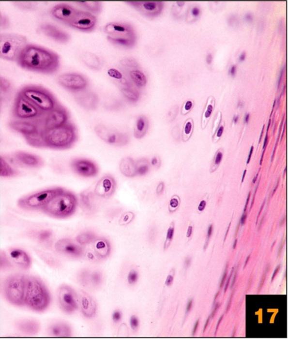 Solved Is This An Example Of Hyaline Cartilage Connective 